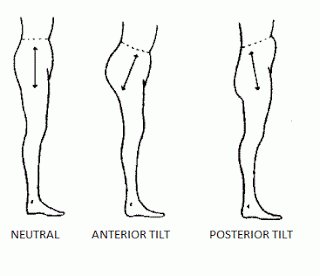 posterior tilt